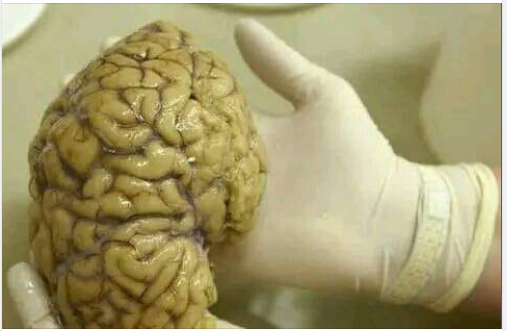 المخ
