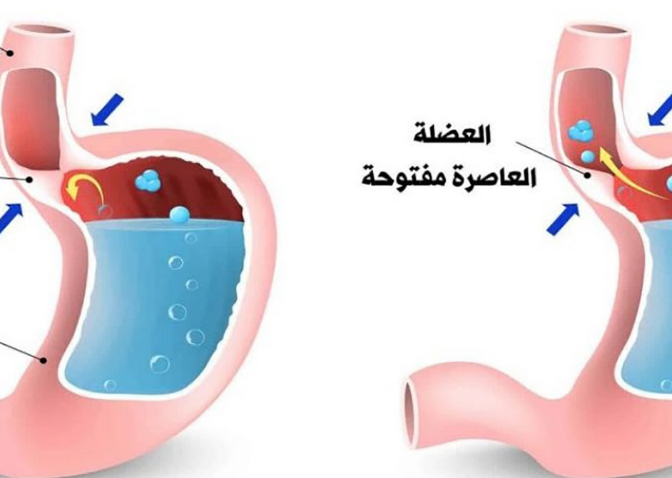 المرئ